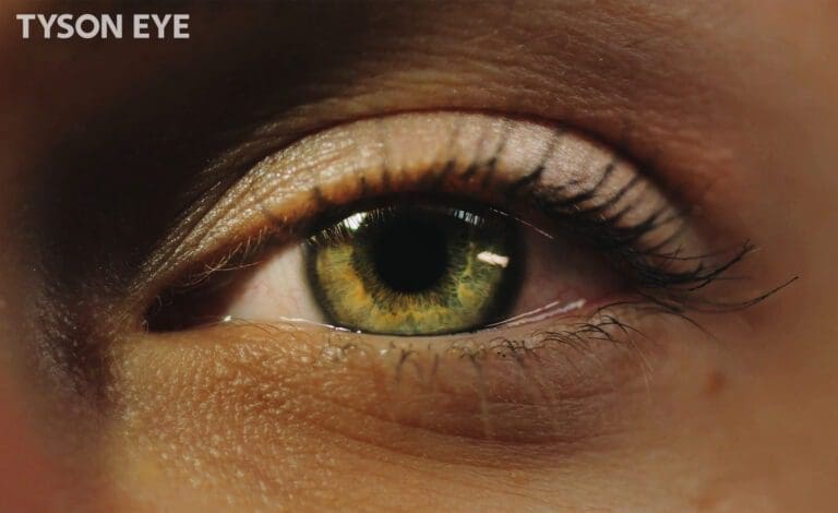 a close up of an eye dilated and how long it lasts