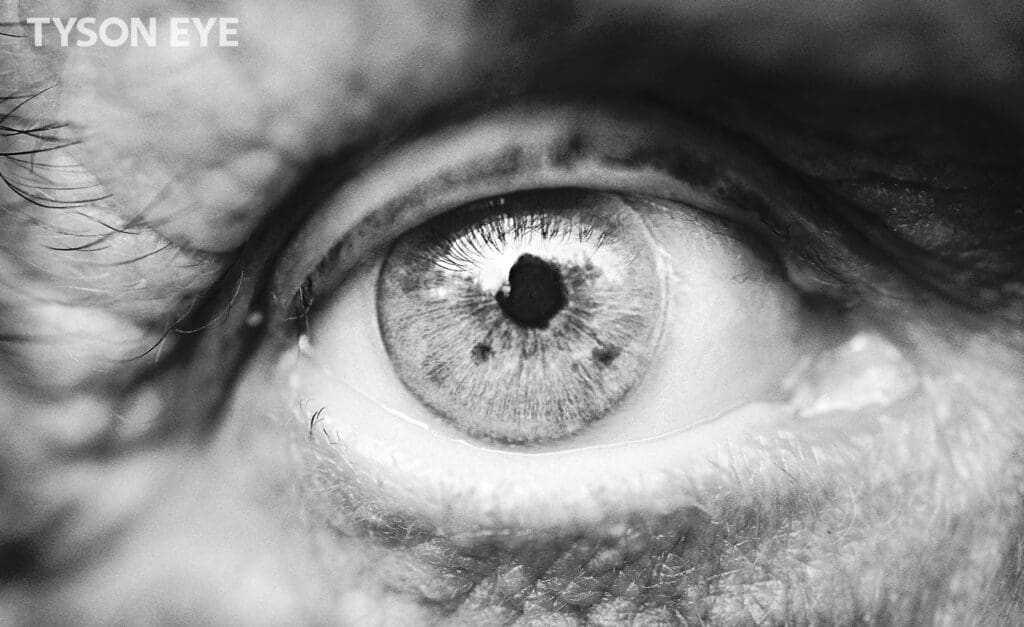 Eyeball showing What is the Retina