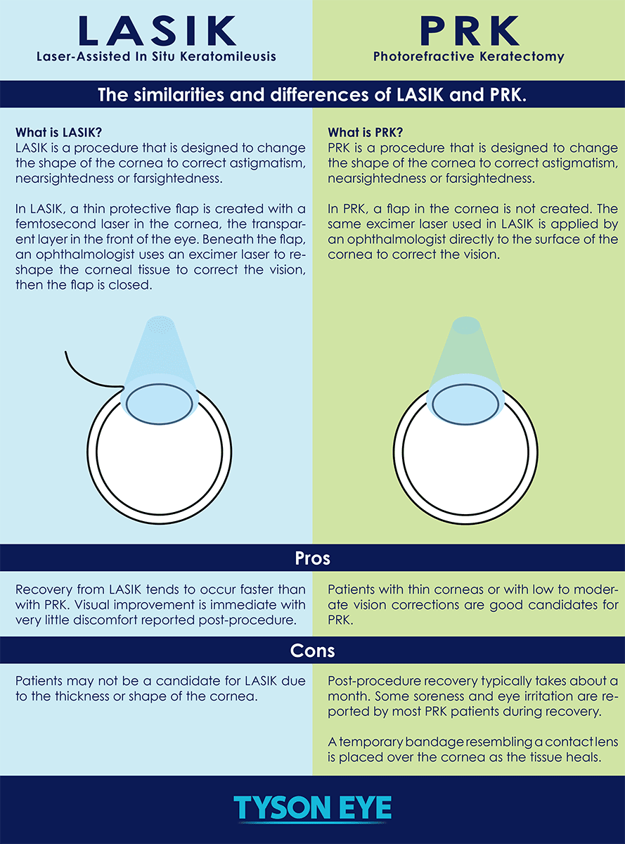 LASIK and PRK comparison infographic