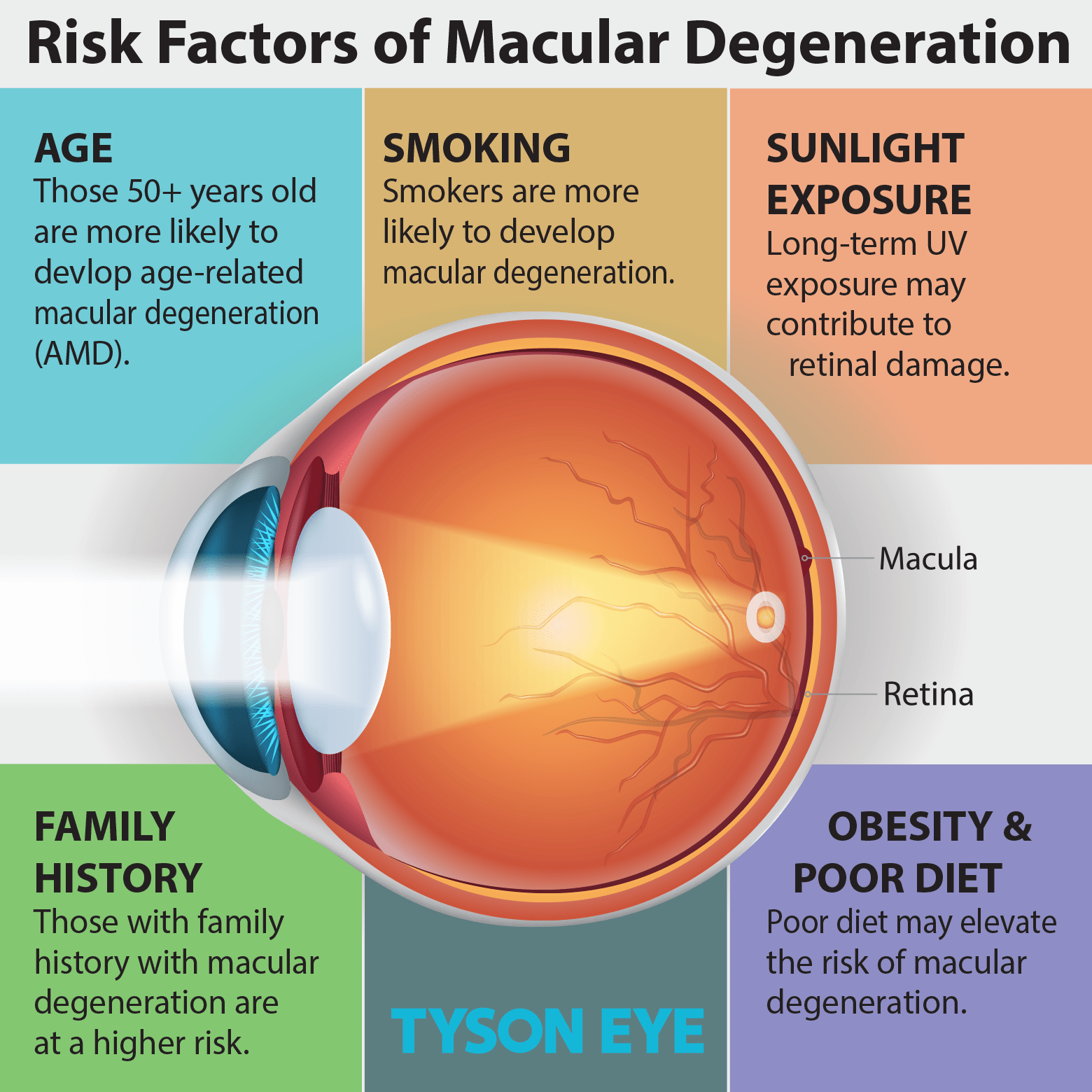 Macular Degeneration infographic going over different risk factors