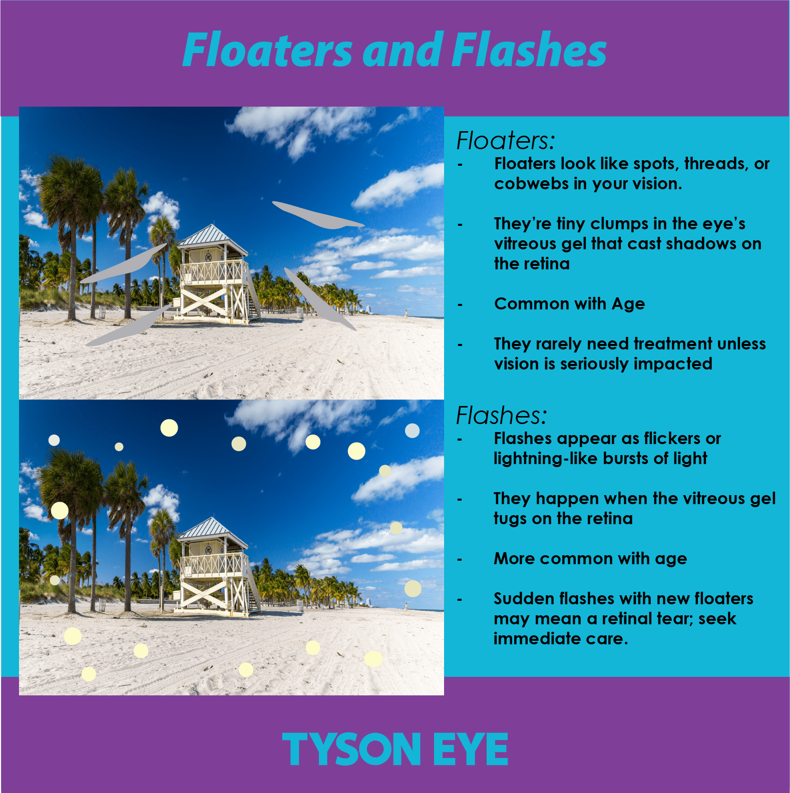 Floaters and Flashes