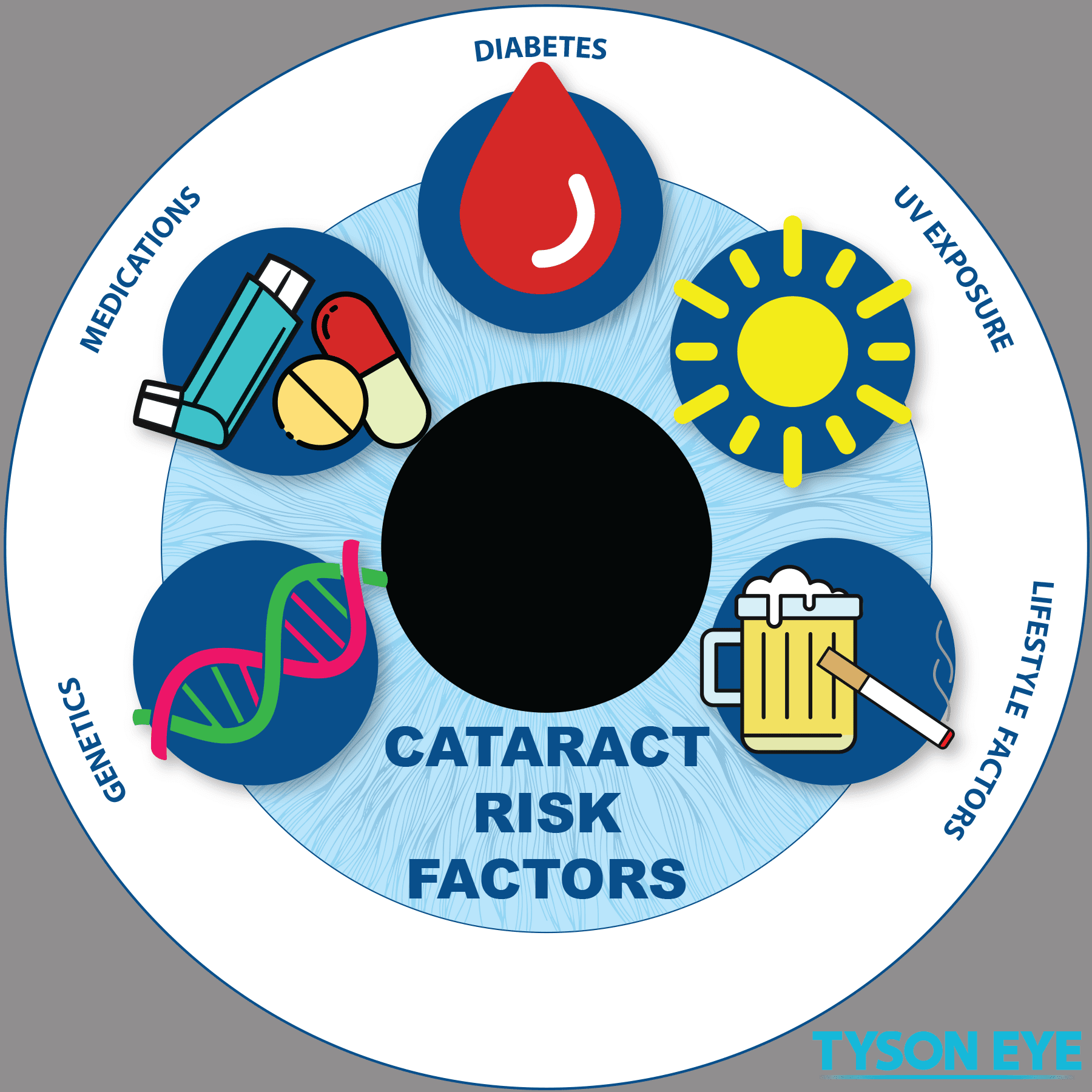 Cataract Risks Infographic