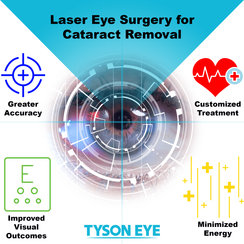 Laser Eye Surgery Cataract Removal